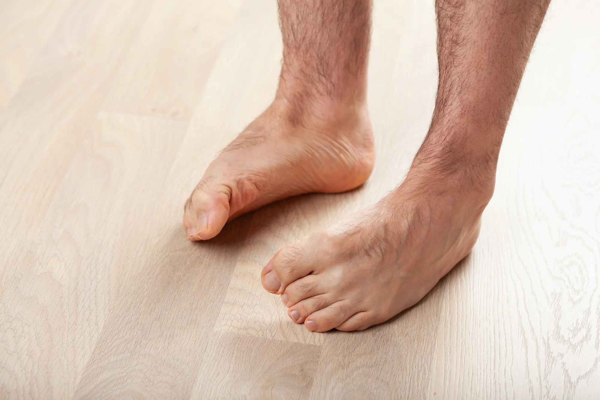 Bare feet of a man standing on a floor showing flat arches
